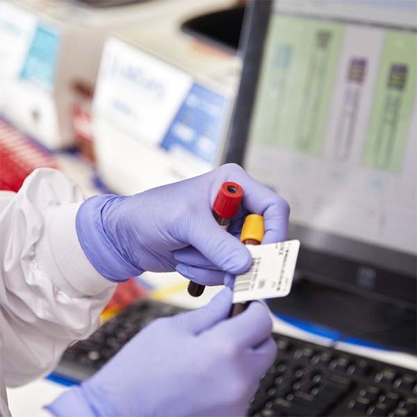 Lab Corp in Sacramento